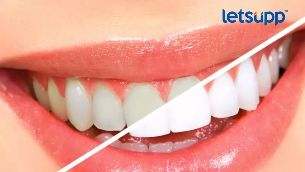 Untitled Design 2023 03 18T154834.317