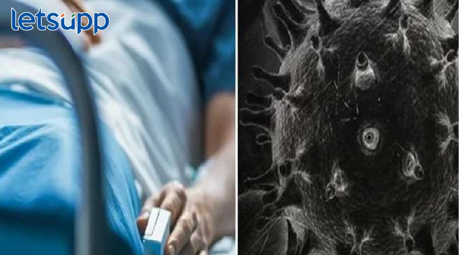 ‘ब्लॅक फंगस’च्या रुग्णांना थ्रीडी तंत्रज्ञानाने मिळणार नवा चेहरा, IIT मद्रासच्या विद्यार्थ्यांनी केला चमत्कार Black Fungus