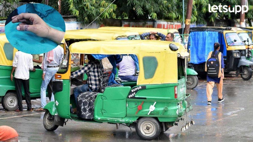 पुण्यातील गंभीर घटना! रिक्षा चालकाने दुचाकीस्वाराला घेतला चावा; अंगठा तुटला