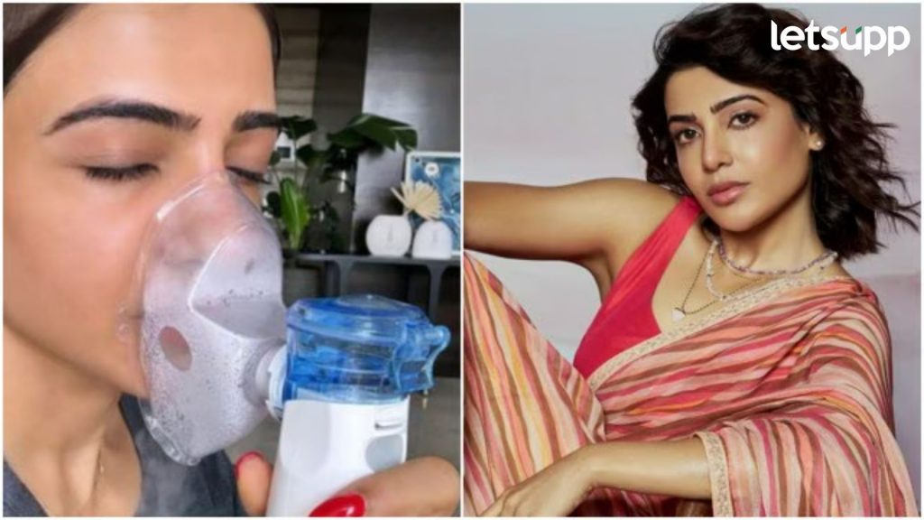 Samantha Ruth: समंथाने आरोग्याशी संबंधित दिलेल्या टिप्सवर डॉक्टरांचा खुलासा, म्हणाले...