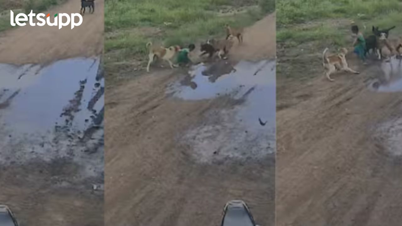 Dog Attack : भटक्या कुत्र्यांचा सुळसुळाट! चाकणमध्ये चिमुरड्यावर जिवघेणा हल्ला Dog Attack : भटक्या कुत्र्यांचा सुळसुळाट! चाकणमध्ये चिमुरड्यावर जिवघेणा हल्ला
