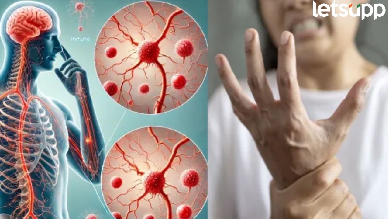पुण्यात गुलेन बॅरी सिंड्रोमचा पहिला बळी, ICU तून हलवलं अन् रूग्णानं सोडला जीव… Pune