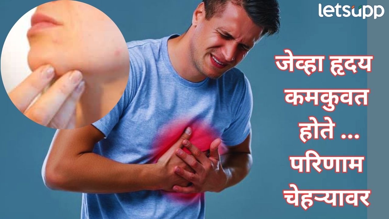 हृदय कमकुवत झालंय? चेहऱ्यावर दिसतात ही ‘चार’ लक्षणे, दुर्लक्ष केल्यास पडेल महागात Health (1)