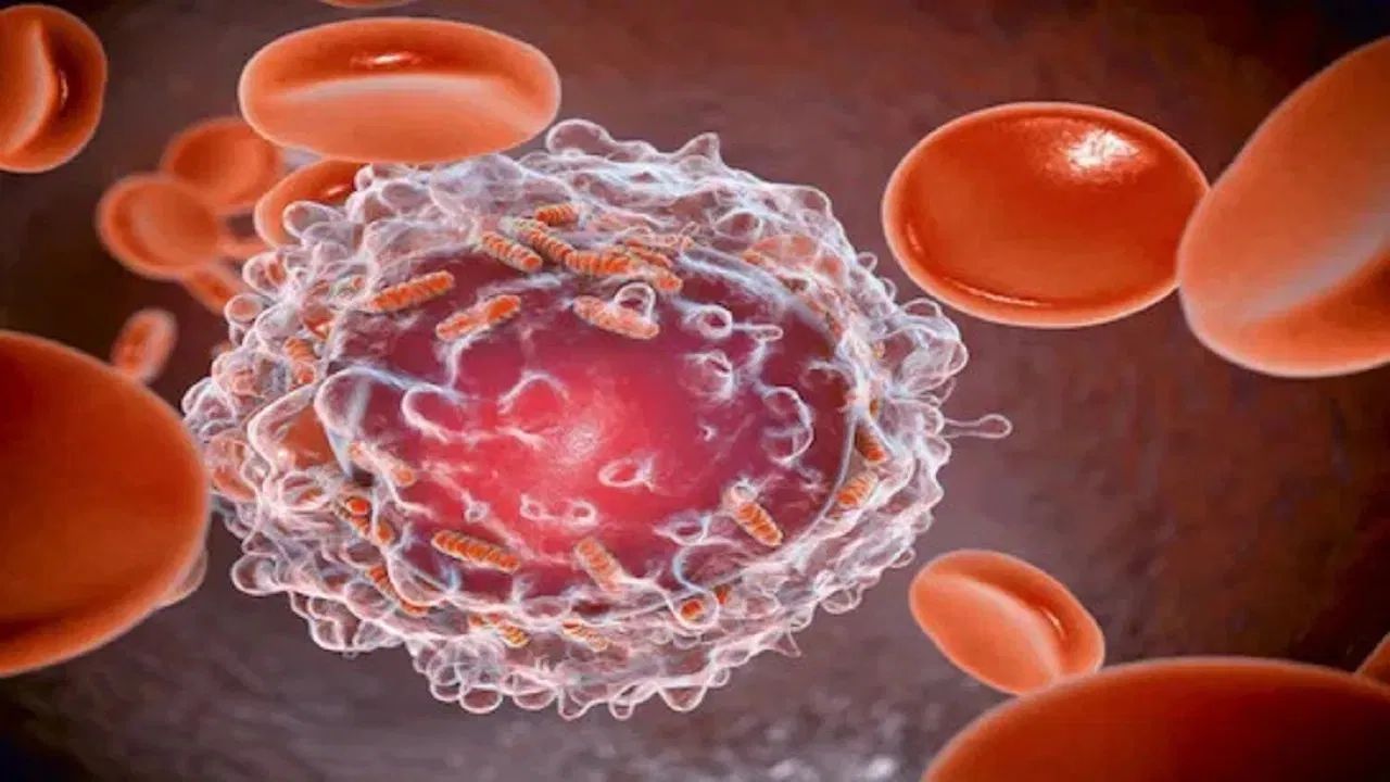बापरे, आता युवकांतही वाढतोय ‘या’ कॅन्सरचा धोका; धक्कादायक अहवाल Appendix Cancer